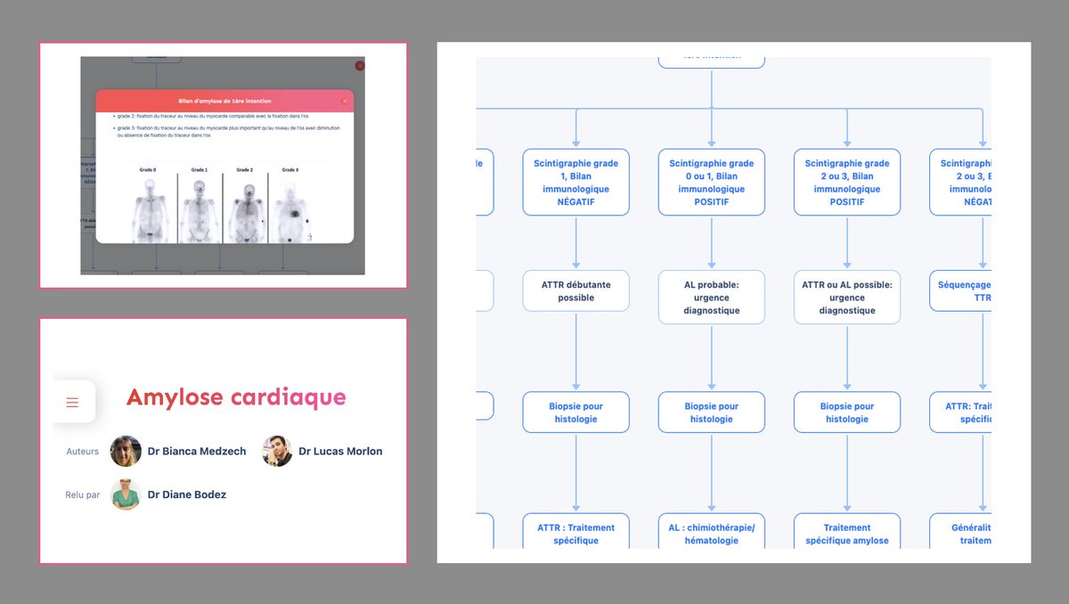 EcoleNumCardio's tweet photo. 🌐 NOUVEL ARBRE ENC : AMYLOSE CARDIAQUE ! 🚦❤️
📲 https://t.co/zHLiT8Lr7a
🆕 Un arbre interactif, du contenu détaillé, validé et pensé pour les cardiologues seniors ! 🔍📈

#Cardiologie #AmyloseCardiaque #ENC #Santé

✨ Likez, partagez et rejoignez la communauté ENC ! 💙 https://t.co/08j2UFHlSd