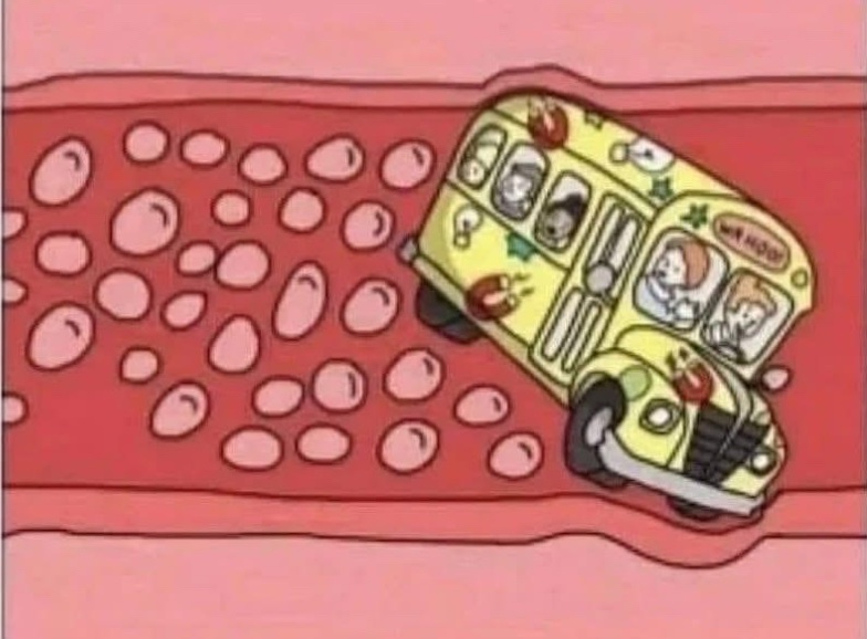 Ms. Frizzle: Okay Explorers! We are in the left anterior descending artery, also known as “The Widowmaker”!

Ralphie: why is that?

Ms. Frizzle *pulls the e-brake, and drifts the bus sideways*