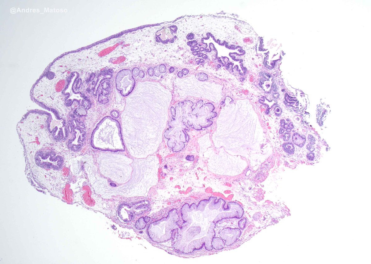 Andres Matoso tweet media