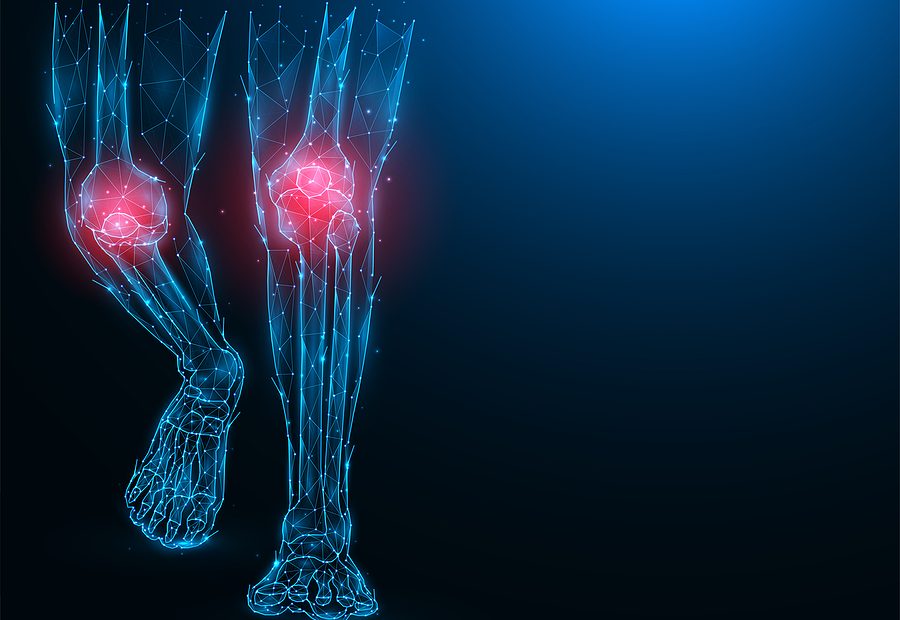 International Milk Genomics Consortium (@imgcmedia) on Twitter photo Check out this SPLASH! Milk Science Update: Extracellular vesicles from cow #milk protect against #osteoarthritis #dairyscience. <a href="/marinacoladas/">Marina Wang</a> milkgenomics.org/?splash=extrac… Check out this SPLASH! Milk Science Update: Extracellular vesicles from cow #milk protect against #osteoarthritis #dairyscience. <a href="/marinacoladas/">Marina Wang</a> milkgenomics.org/?splash=extrac…