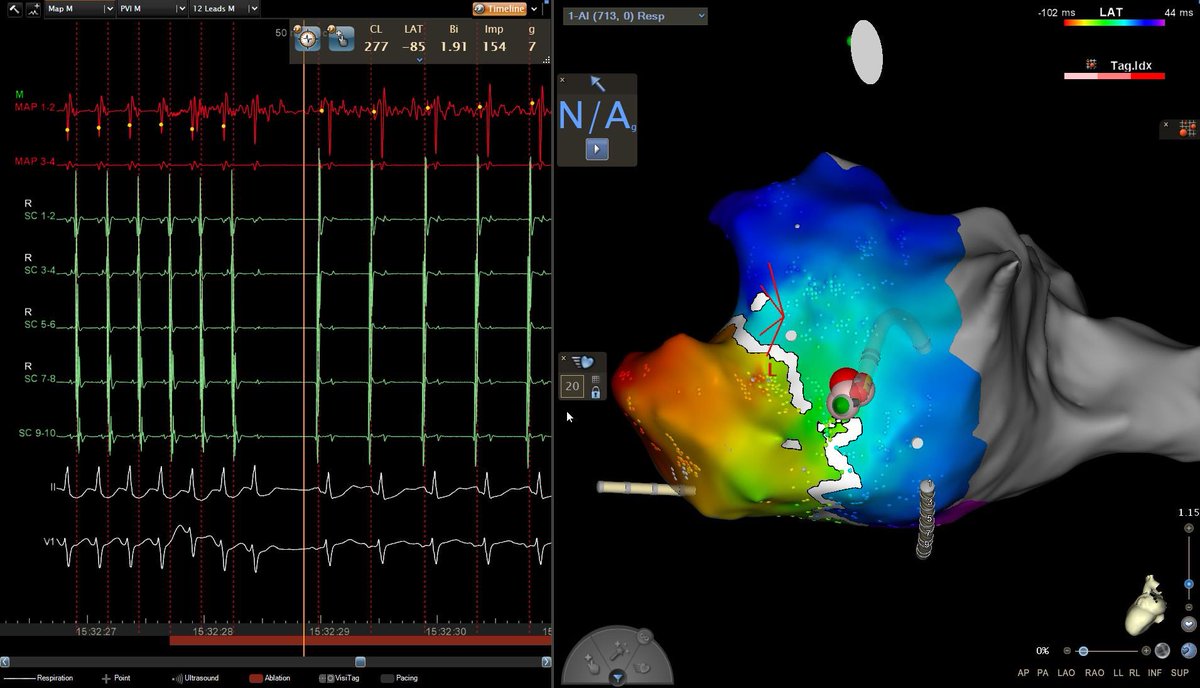 Pasquale V. Falzone tweet media