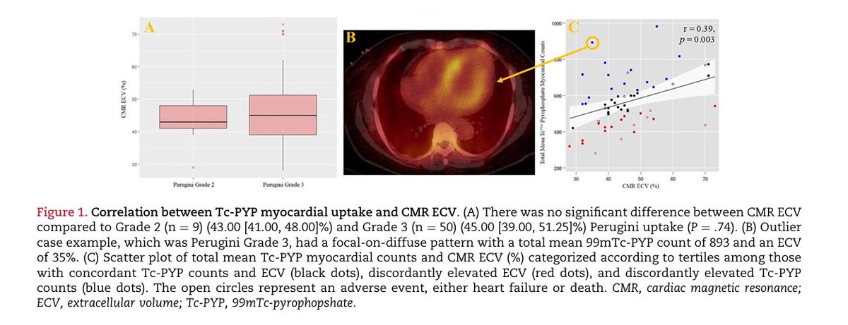 Journal of Nuclear Cardiology (@jncjournal) on Twitter photo Among 59 patients with ATTR cardiac amyloidosis diagnosed by visual grade 2 or 3 Tc-PYP uptake, the magnitude of Tc-PYP abnormality by visual grading correlated only weakly with ECV via CMR. <a href="/PaulCremerMD/">Paul Cremer MD</a> <a href="/NorthwesternMed/">Northwestern Medicine</a>
Read now👉bit.ly/3EQJRdx
#cvnuc #amyloidosis Among 59 patients with ATTR cardiac amyloidosis diagnosed by visual grade 2 or 3 Tc-PYP uptake, the magnitude of Tc-PYP abnormality by visual grading correlated only weakly with ECV via CMR. <a href="/PaulCremerMD/">Paul Cremer MD</a> <a href="/NorthwesternMed/">Northwestern Medicine</a>
Read now👉bit.ly/3EQJRdx
#cvnuc #amyloidosis