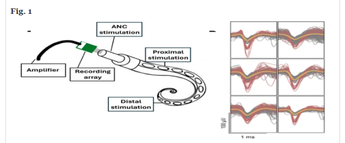 February publication: In vivo electrophysiology recordings and computational modeling can predict octopus arm movement #BioelectronicMedicine #octopus #electrophysiology #neuraldecoding #machinelearning bioelecmed.biomedcentral.com/articles/10.11…