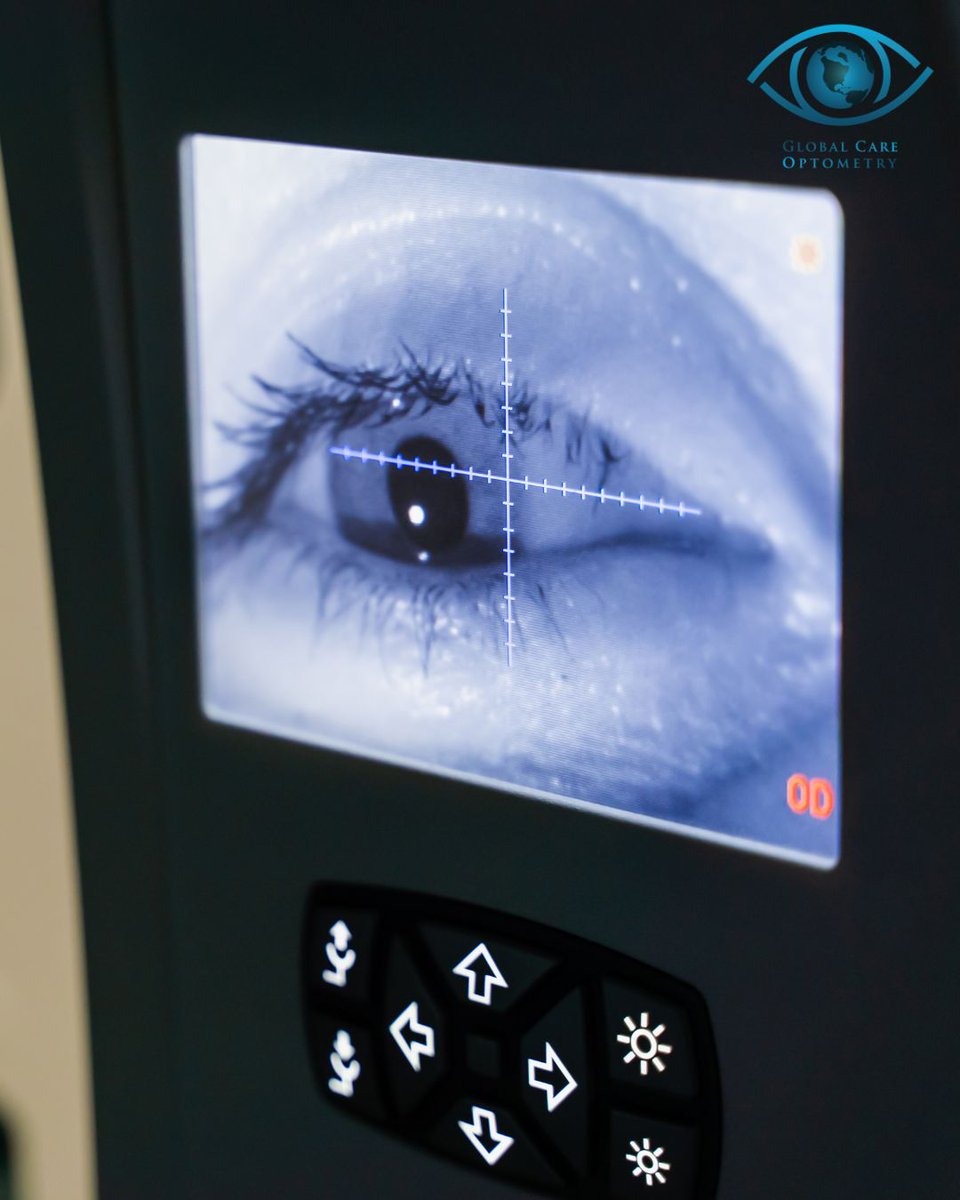 Testing your peripheral vision is crucial for detecting issues like glaucoma. Schedule an appointment to come see us! 👀

#optometry #globalcare #eyecare #awareness #careers #eyedoctors #graduates #rewardingcareer #doctors #eyes