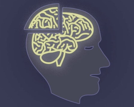 🧠 WEBINAR ALERT: Post-Concussion Syndrome 🧠

Every year, 1.5M TBIs lead to PCS—causing lingering symptoms like headaches, dizziness &amp; brain fog. Join Dr. David Kunashko to learn how BioFlex Laser Therapy can help accelerate recovery.

🔗 Register: bioflexlaser.com/webinar-regist…