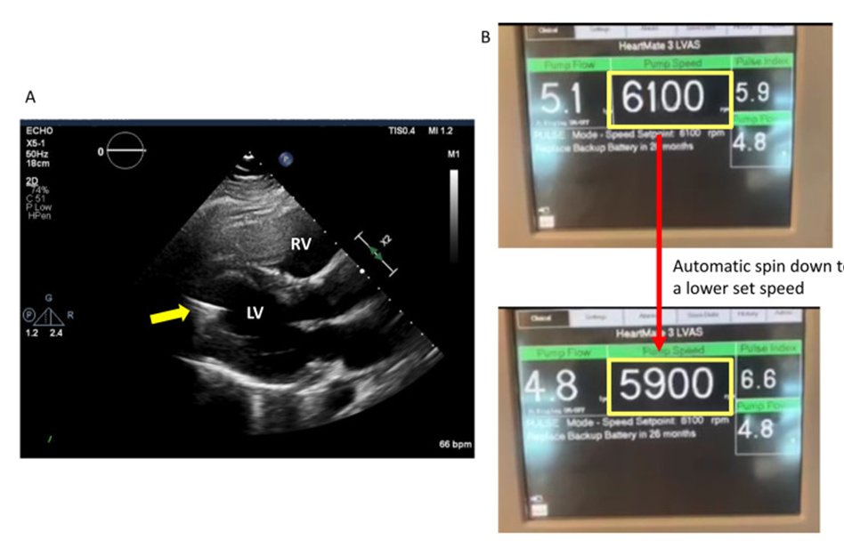 Jerry Estep tweet media