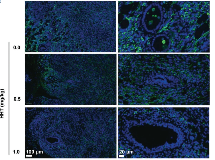 🥳Recommended Paper: Homoharringtonine inhibits #PancreaticCancer progression via #mitochondrial energy metabolism suppression and #macrophages reduction
By: Haiyan Xu et al.
Free Access:👇👇
accscience.com/journal/TD/art…