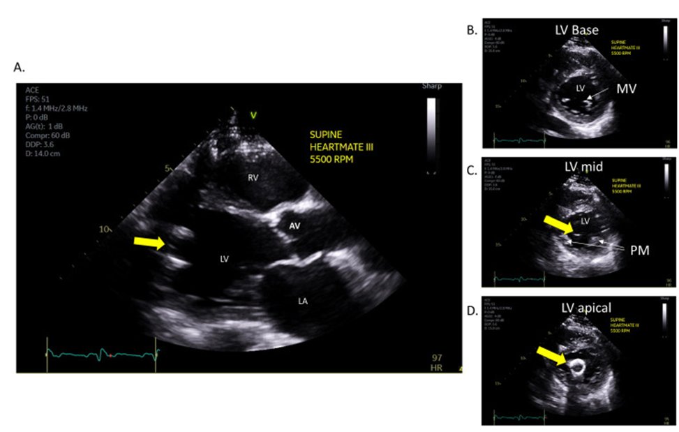 Jerry Estep tweet media