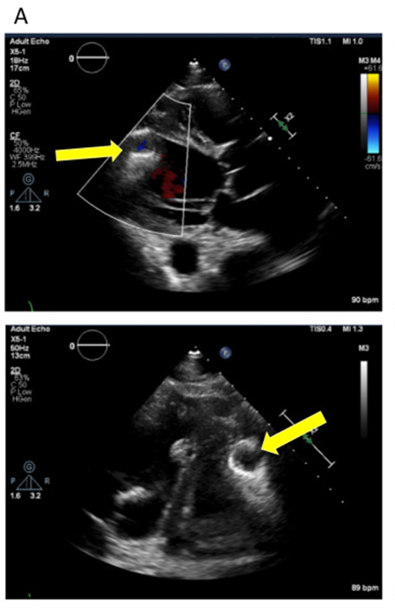 Jerry Estep tweet media