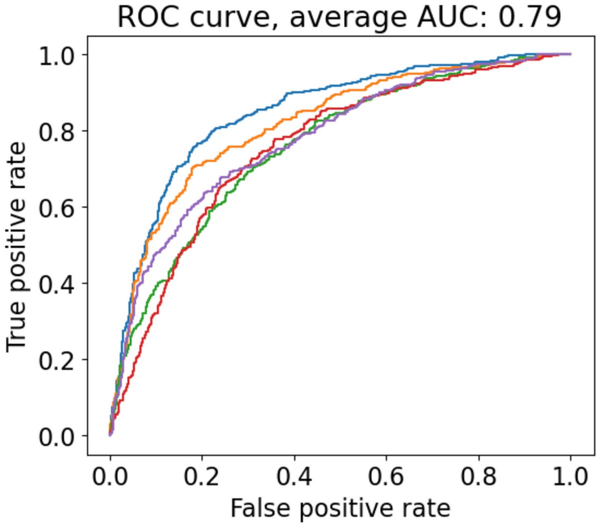JAHA (@jaha_aha) on Twitter photo Digital stethoscopes + AI can accurately identify elevated pulmonary artery pressures, offering a point-of-care screening tool for #PulmonaryHypertension. #AHAJournals <a href="/GChoudharyMD/">Gaurav Choudhary</a> <a href="/Eko_Health/">Eko Health</a> <a href="/BrownMedicine/">The Warren Alpert Medical School</a> <a href="/VAResearch/">VA Research</a> Digital stethoscopes + AI can accurately identify elevated pulmonary artery pressures, offering a point-of-care screening tool for #PulmonaryHypertension. #AHAJournals <a href="/GChoudharyMD/">Gaurav Choudhary</a> <a href="/Eko_Health/">Eko Health</a> <a href="/BrownMedicine/">The Warren Alpert Medical School</a> <a href="/VAResearch/">VA Research</a>