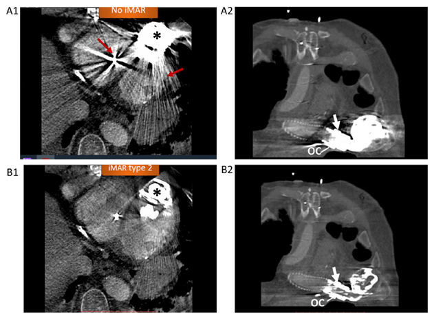 Bo Xu MD, FACC, FASE tweet media