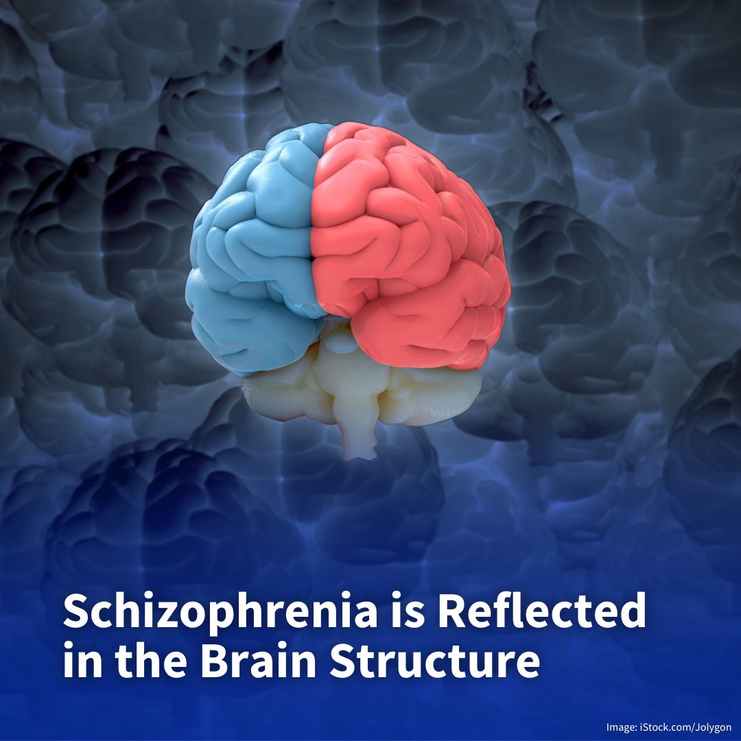 University of Zurich (@uzh_en) on Twitter photo A new study on patients with schizophrenia finds less flexible brain development in early childhood, particularly in areas responsible for connecting cognitive and emotional processes: news.uzh.ch/en/articles/me… <a href="/philipphoman/">Philipp Homan</a> A new study on patients with schizophrenia finds less flexible brain development in early childhood, particularly in areas responsible for connecting cognitive and emotional processes: news.uzh.ch/en/articles/me… <a href="/philipphoman/">Philipp Homan</a>