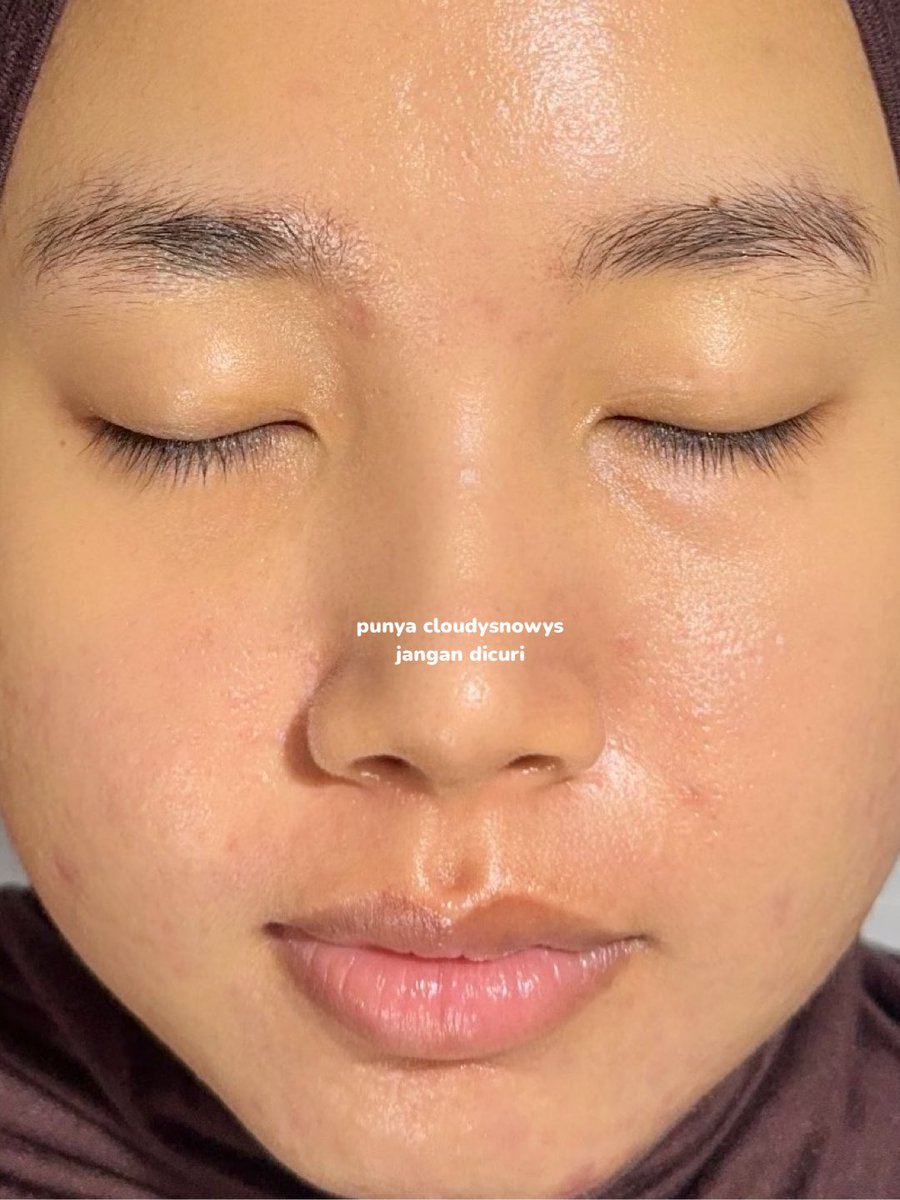 "KONSUL DI HALODOC WORTH IT GA?"

aku mau sharing pengalaman aku konsul di halodoc pas aku breakout tahun lalu &amp; produk apa aja yang aku pakai selama breakout 👌🏻

simak threadnya sampai selesai 👇🏻