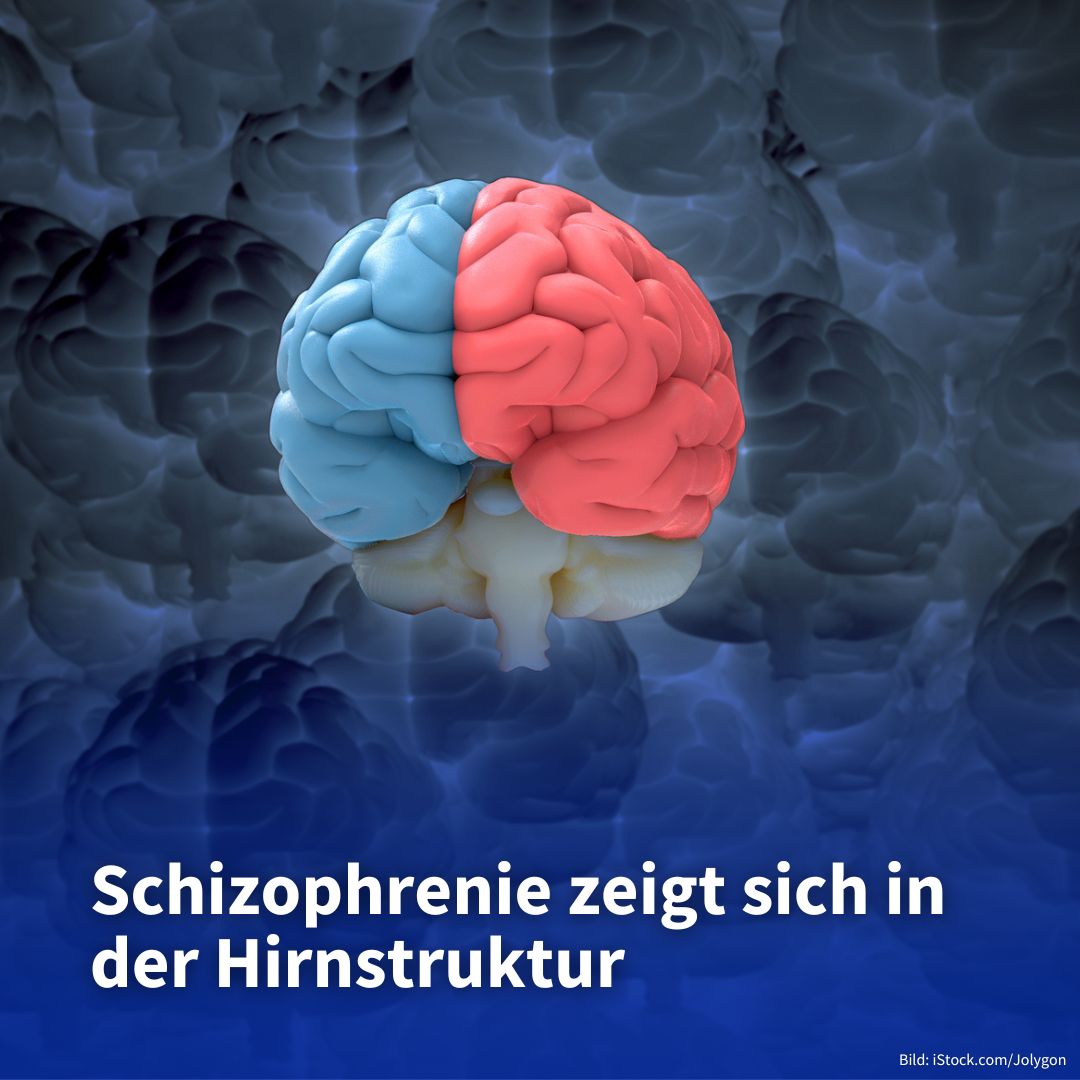 Universität Zürich (@uzh_ch) on Twitter photo Eine neue Studie zu Schizophrenie zeigt eine weniger flexible Gehirnentwicklung in früher Kindheit, insbesondere in Bereichen, die für die Verbindung von Denk- und Fühlvorgängen zuständig sind: news.uzh.ch/de/articles/me… <a href="/philipphoman/">Philipp Homan</a> Eine neue Studie zu Schizophrenie zeigt eine weniger flexible Gehirnentwicklung in früher Kindheit, insbesondere in Bereichen, die für die Verbindung von Denk- und Fühlvorgängen zuständig sind: news.uzh.ch/de/articles/me… <a href="/philipphoman/">Philipp Homan</a>