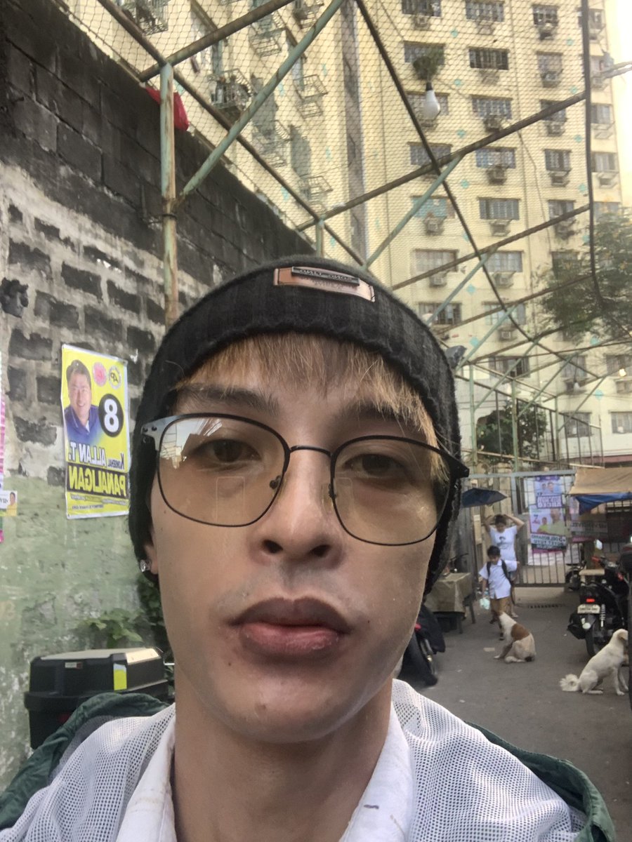 Before and after ng work🥸🥴
