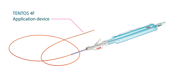 Aquilantvasc's tweet photo. ⭐️PRODUCT FOCUS⭐️
The #Tentos 4F stent from Optimed is perfect for treating infrapopliteal and femoral arteries🤩
✅4F delivery system
✅.018 guide wire
✅Open cell design
✅Anti-jump technique
✅Atraumatic soft tip
✅Wide selection of stent sizes
#VascularIR
Find us at #FYA2025 https://t.co/BuAsadaH8e