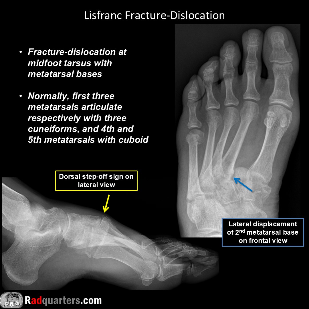 Radquarters's tweet image. #FOAMrad #FOAMed #radres #mskrad #radtech #medstudent #radquarters
