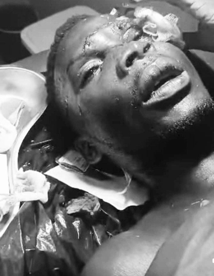 Uganda Journalist Association (@ujaofficial) on Twitter photo We are very disturbed by the brutal attack on one of our own Miracle Ibra, a journalist with Top Tv who has been badly hit with an explosive by the security personnel while in line of duty. <a href="/PoliceUg/">Uganda Police Force</a>
<a href="/MODVA_UPDF/">Uganda Peoples' Defence Forces</a> <a href="/mkituuma/">Kituuma Rusoke</a> <a href="/Lukowoyesigyire/">Owoyesigyire</a> <a href="/igp_ug1/">ABAS BYAKAGABA</a> <a href="/mediadefence/">Media Defence</a> <a href="/MediaDefenceSEA/">Media Defence SEA</a> We are very disturbed by the brutal attack on one of our own Miracle Ibra, a journalist with Top Tv who has been badly hit with an explosive by the security personnel while in line of duty. <a href="/PoliceUg/">Uganda Police Force</a>
<a href="/MODVA_UPDF/">Uganda Peoples' Defence Forces</a> <a href="/mkituuma/">Kituuma Rusoke</a> <a href="/Lukowoyesigyire/">Owoyesigyire</a> <a href="/igp_ug1/">ABAS BYAKAGABA</a> <a href="/mediadefence/">Media Defence</a> <a href="/MediaDefenceSEA/">Media Defence SEA</a>