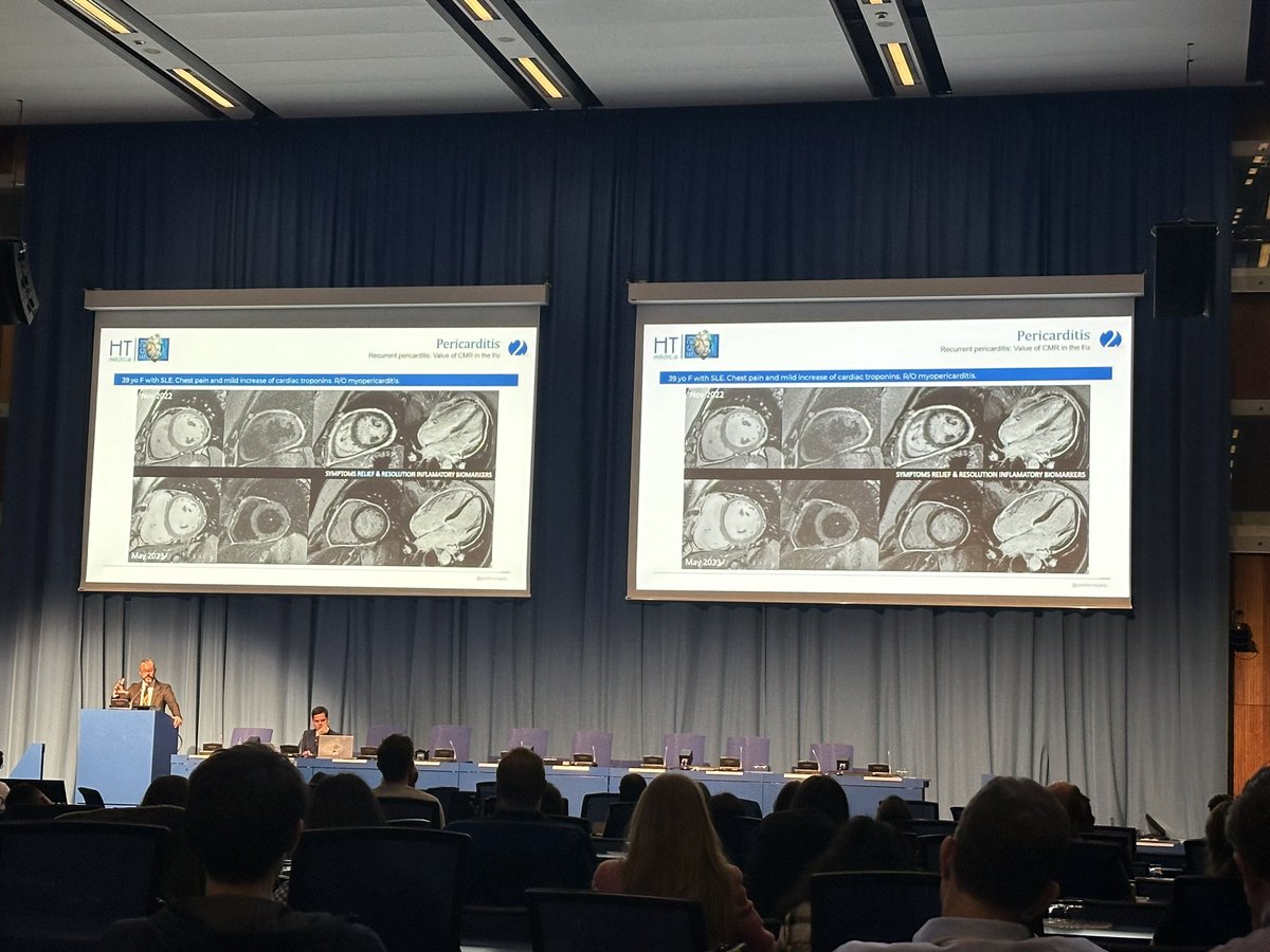 Blanca Domenech-Ximenos (@blanca_domenech) on Twitter photo Dr <a href="/JordiBroncano/">Jordi Broncano</a> taking the stage at #ECR2025 - assessing the pericardium 🧲🧲🧲
#WhyCMR <a href="/EscrOffice/">ESCR Vienna</a> <a href="/myESR/">myesr</a> <a href="/Marcelo97843311/">Marcelo Sanchez</a> <a href="/GiuseppeMuscog/">Giuseppe Muscogiuri</a> <a href="/Alunaalcala/">Antonio Luna Alcalá</a> <a href="/salvasapedraza/">Salvador Pedraza</a> Dr <a href="/JordiBroncano/">Jordi Broncano</a> taking the stage at #ECR2025 - assessing the pericardium 🧲🧲🧲
#WhyCMR <a href="/EscrOffice/">ESCR Vienna</a> <a href="/myESR/">myesr</a> <a href="/Marcelo97843311/">Marcelo Sanchez</a> <a href="/GiuseppeMuscog/">Giuseppe Muscogiuri</a> <a href="/Alunaalcala/">Antonio Luna Alcalá</a> <a href="/salvasapedraza/">Salvador Pedraza</a>