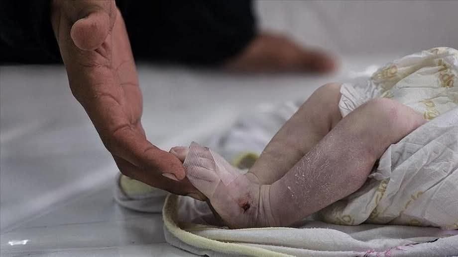Newborn baby Sila Abd Alqader, just 46 days old, died today in Al-Shuja’iya, Gaza, due to the freezing cold and lack of proper shelter.

Yesterday, six more newborns lost their lives the same way.