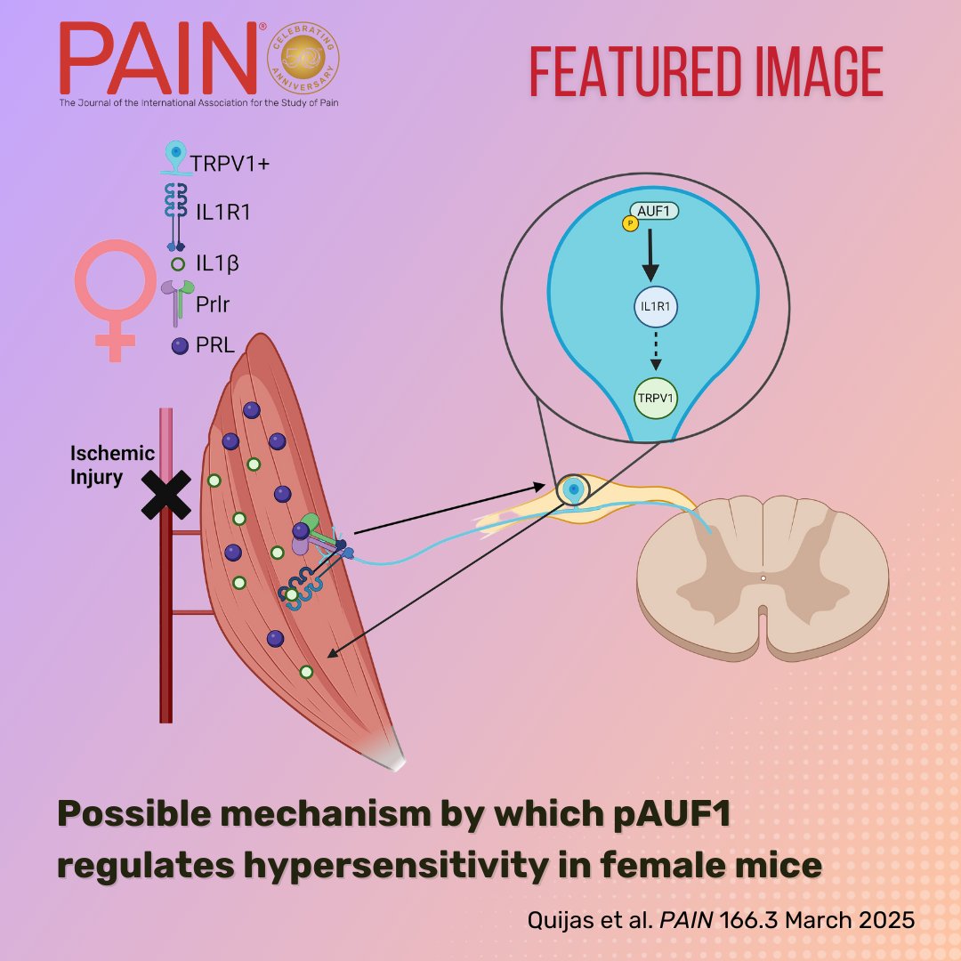 PAIN Journal (@painthejournal) on Twitter photo <a href="/JankowskiLab/">Jankowski Lab</a> et al. find that, in a model of repeated ischemic injury to the muscles, sensory neuron expression of AUF1 modulates sex-specific behavioral responses and dorsal root ganglion gene expression patterns. Learn more in #PAIN bit.ly/41gooDe <a href="/JankowskiLab/">Jankowski Lab</a> et al. find that, in a model of repeated ischemic injury to the muscles, sensory neuron expression of AUF1 modulates sex-specific behavioral responses and dorsal root ganglion gene expression patterns. Learn more in #PAIN bit.ly/41gooDe