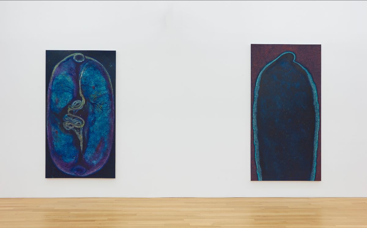 Peter Blum Gallery tweet media