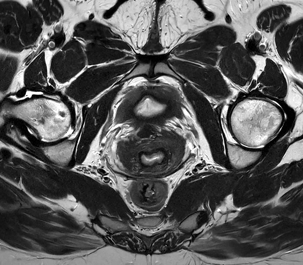 Dx_imaging's tweet image. . @PhilipsHealth Launches #AI Powered SmartSpeed Precise #MRI Software at #ECR2025 
diagnosticimaging.com/view/philips-l…
@ACRRFS @ACRYPS @RadiologyACR @ARRS_Radiology @RSNA @ISMRM @YaleRadiology @PennRadiology @Hopkins_Rad @DukeRadiology @NYUImaging @UABRadiology 
#radiology #RadRes