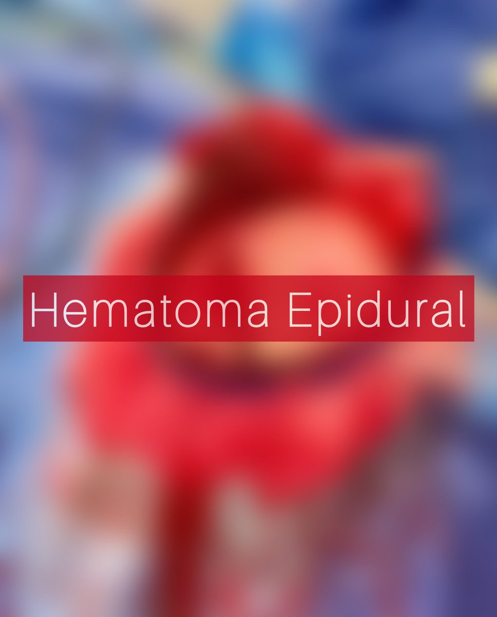 neurocirugia_pr's tweet photo. Los hematomas epidurales son un tipo de sangrado intracranial que consisten en la acumulación de sangre entre el cráneo y la duramadre, generalmente asociados a traumatismos craneoencefálicos de alta energía. https://t.co/ix2ZbPwhhc