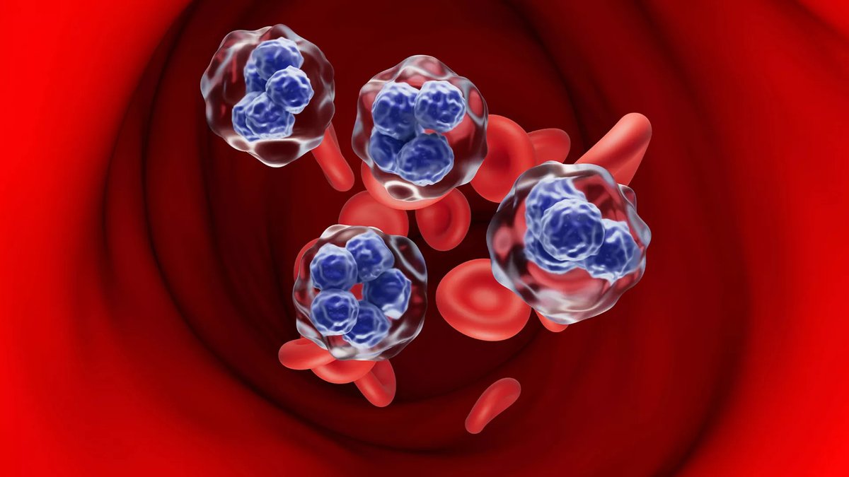 Einstein Research: Promising Cell Therapy for Relapsed/Refractory T-Cell Lymphomas

Learn more at bit.ly/43ccwn9
#Cancer #CancerResearch #MECCC