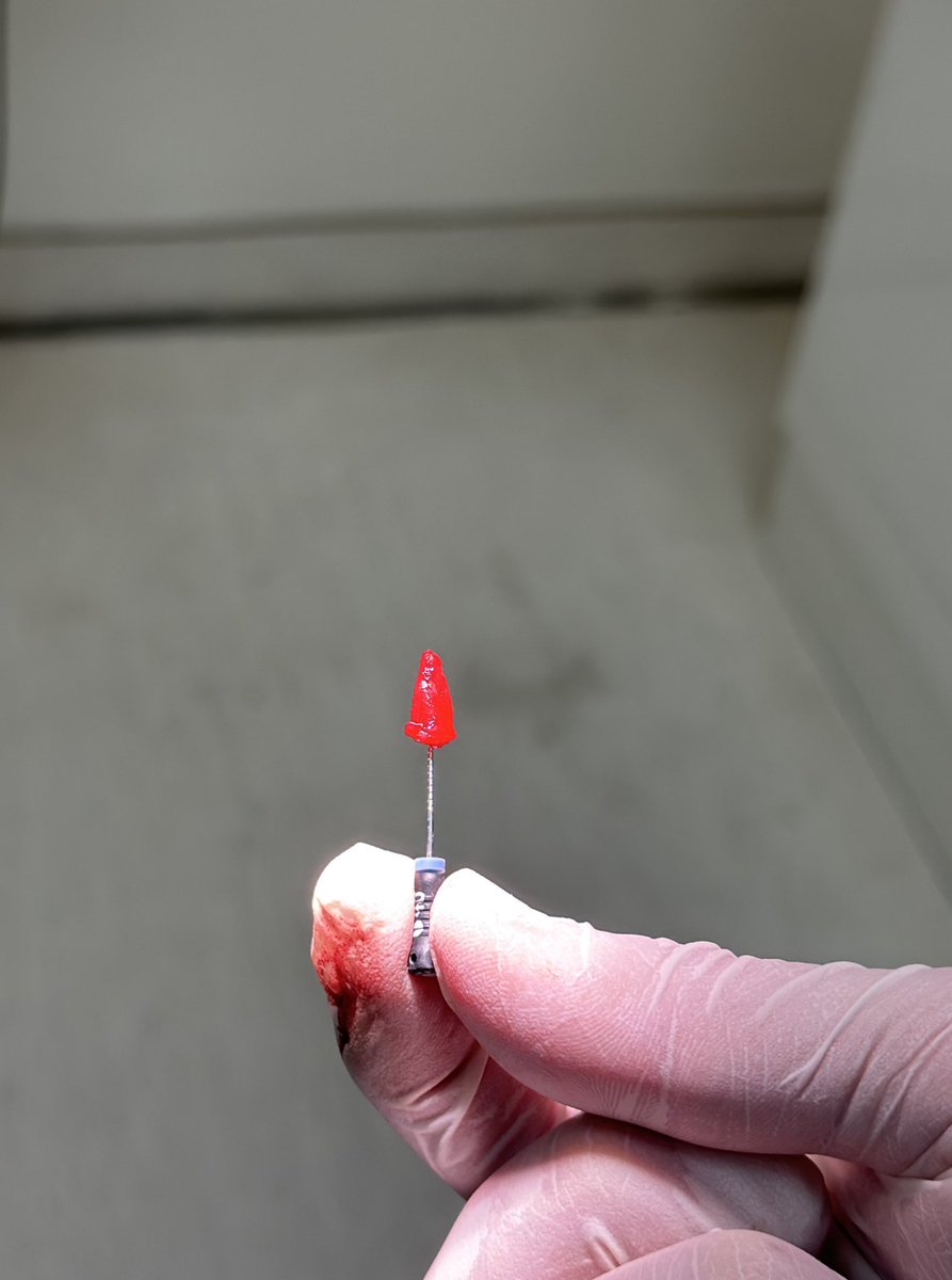 trigeminal_V's tweet image. Sometimes it could be as easy as pie