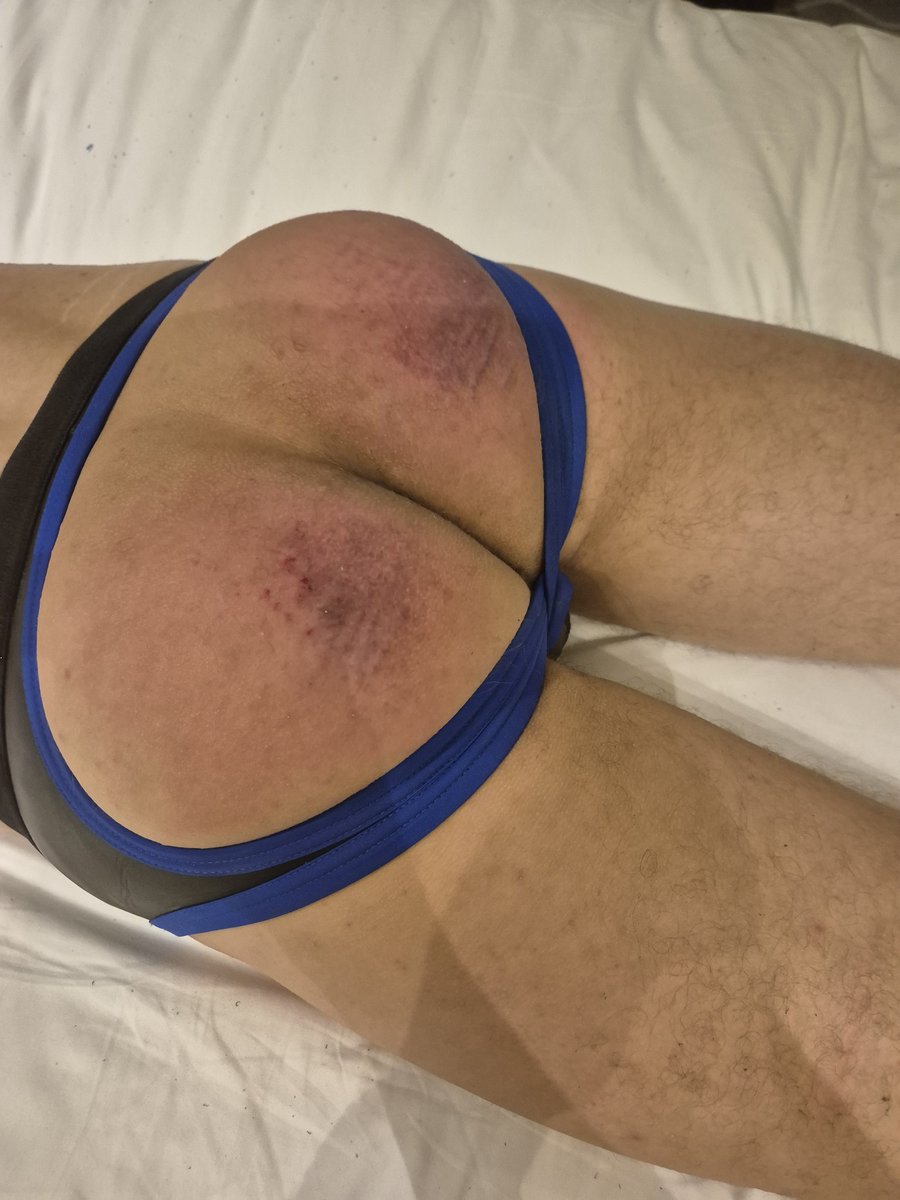 <a href="/RubberpupYuki/">Bouncy Yuki</a> wanted to test his pain limits
His body started giving out before his tolerance did xD. Anyone else want a go?