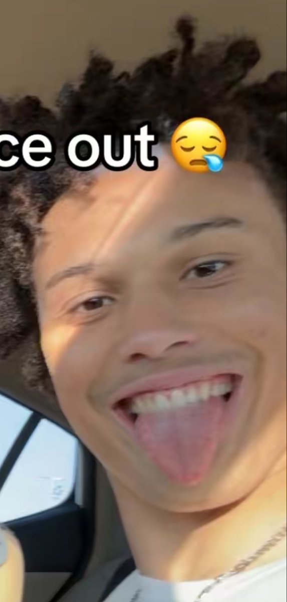 Is it just me or does this kid piss you off the way he’s always posting his little dog or some dumbass pic?