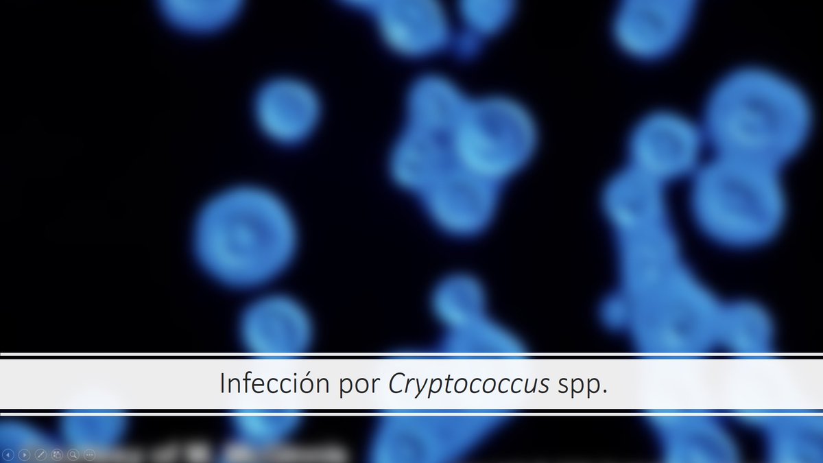Micro_LaPaz's tweet image. 🖥️ #Sesión: Hoy comentamos un caso de #criptococosis 🥜 en paciente sin factores de riesgo e inmunocompetente y hacemos una revisión de la literatura de la infección por #Cryptococcus 🍄 ¡Gracias por la sesión y enhorabuena como siempre @Pili_Viz 🫶🏻!