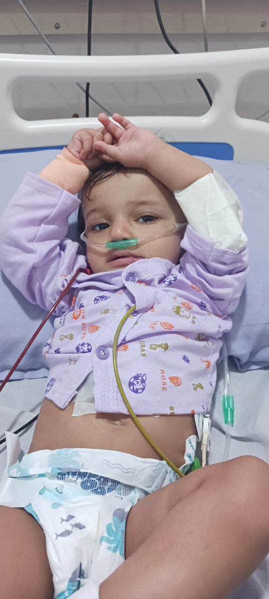 SbccHealth's tweet image. જેતપુર તાલુકાની નેત્રા જન્મજાત હૃદયની  ખામી હતી. RBSK પ્રોગ્રામ અંતર્ગત વિનામૂલ્યે સફળ સર્જરી કરી મળ્યું નવું જીવન પરિવારે આરોગ્યની ટીમ અને  સરકારનો આભાર માન્યો @RajkotCdho00031 @DDORAJKOT1 @CollectorRjt @NHMGujarat @GujHFWDept