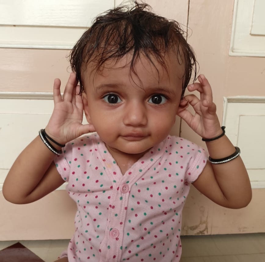 SbccHealth's tweet image. જેતપુર તાલુકાની નેત્રા જન્મજાત હૃદયની  ખામી હતી. RBSK પ્રોગ્રામ અંતર્ગત વિનામૂલ્યે સફળ સર્જરી કરી મળ્યું નવું જીવન પરિવારે આરોગ્યની ટીમ અને  સરકારનો આભાર માન્યો @RajkotCdho00031 @DDORAJKOT1 @CollectorRjt @NHMGujarat @GujHFWDept