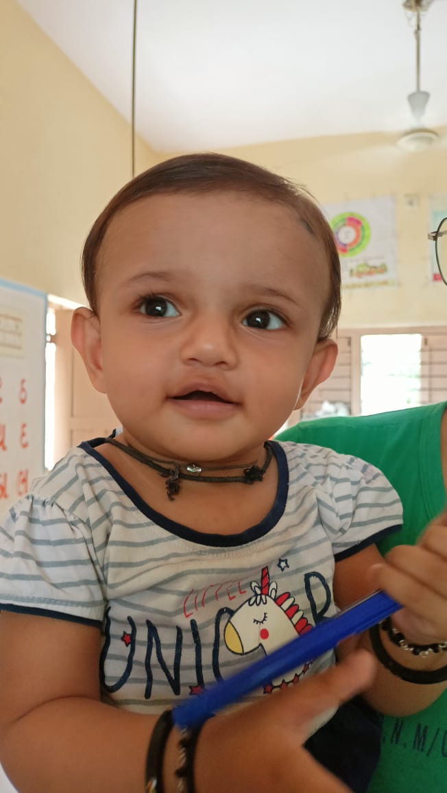 SbccHealth's tweet image. જેતપુર તાલુકાની નેત્રા જન્મજાત હૃદયની  ખામી હતી. RBSK પ્રોગ્રામ અંતર્ગત વિનામૂલ્યે સફળ સર્જરી કરી મળ્યું નવું જીવન પરિવારે આરોગ્યની ટીમ અને  સરકારનો આભાર માન્યો @RajkotCdho00031 @DDORAJKOT1 @CollectorRjt @NHMGujarat @GujHFWDept