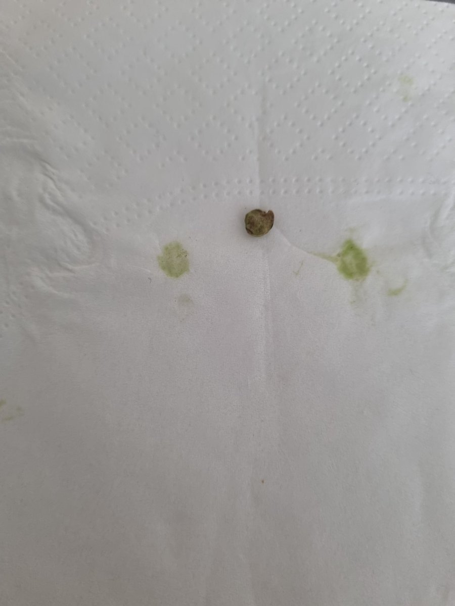 Compro gli spinaci novelli da #Esselunga in viale Piave per fare una pausa pranzo veloce e sana, quelli già lavati e pronti da mangiare, e ci trovo dentro un sassolino (neppure così piccolo) che mi ha scheggiato un dente 🤬🤬🤬

Alla faccia del controllo qualità