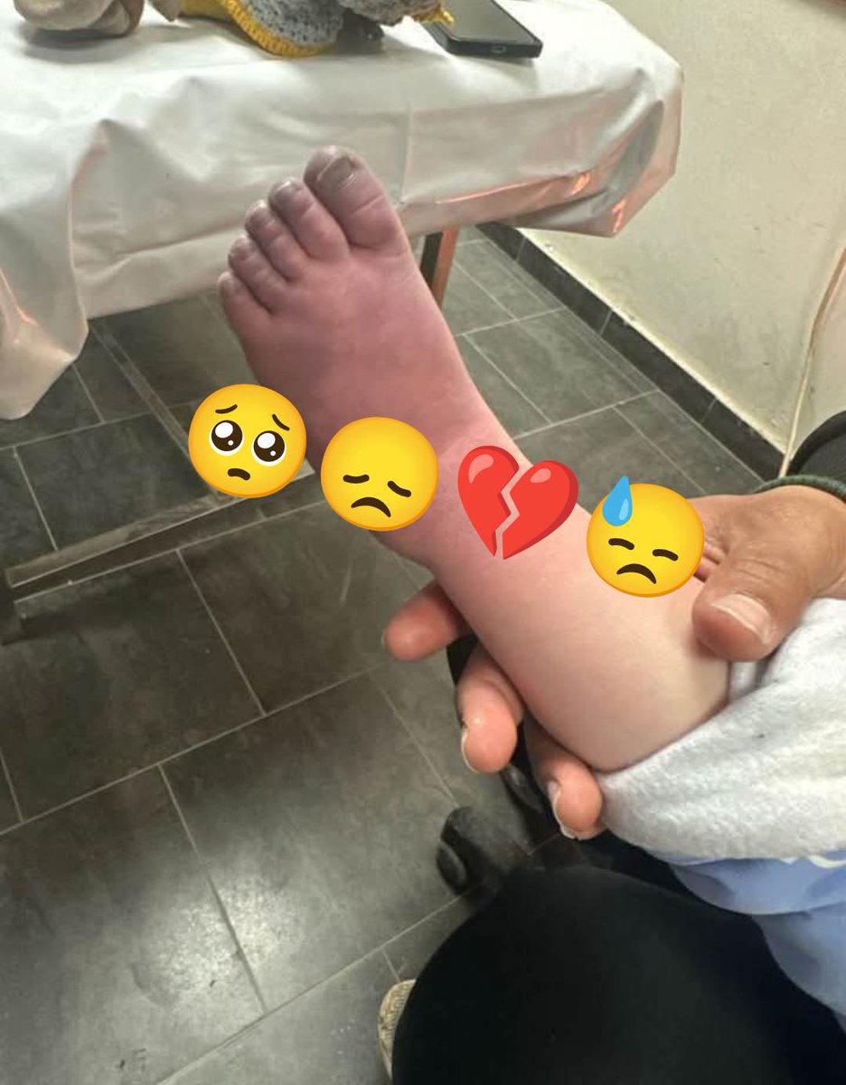 WE ARE SO COLD

IT IS VERY COLD in the tents,my brother's feet have turned blue, he is shivering from the cold and feeling hungry I am very afraid that my brother will lose his feet from the cold, please help us by providing some clothes and heavy blankets
gofundme.com/f/help-muhamma…