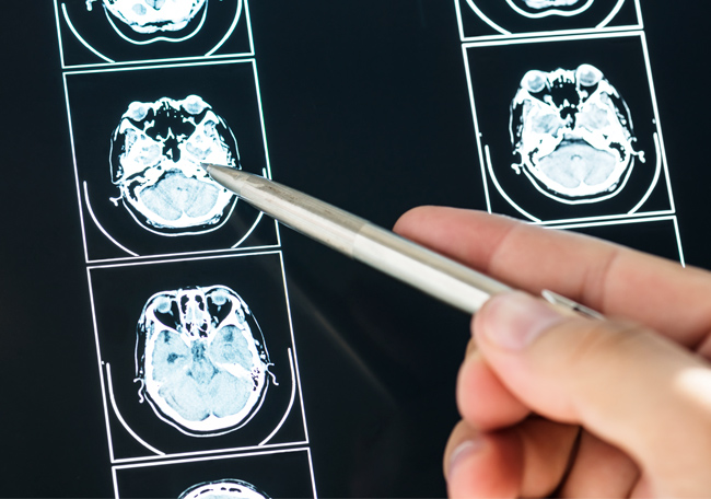 Especialización en Trabajar con Víctimas de Experiencias Traumáticas

La docencia sobre víctimas de experiencias traumáticas, con una perspectiva interdisciplinar, resulta tan necesaria como escasa. Este posgrado cubre este hueco.

➡️bit.ly/3LjTyRe