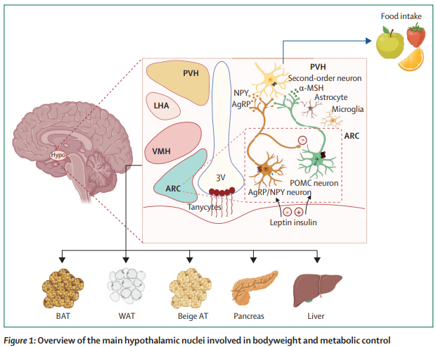 TheLancetEndo's tweet image. #Hypothalamic #obesity: from basic mechanisms to clinical perspectives thelancet.com/journals/landi…  
#hyperphagia
