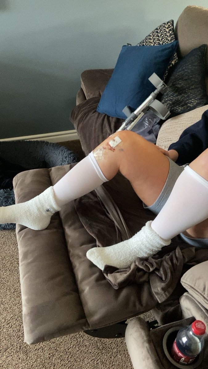 RobinHorsler's tweet photo. 90 degrees. ACL reconstruction. Progress. Countdown to playing again continues. https://t.co/hUAM4RZown