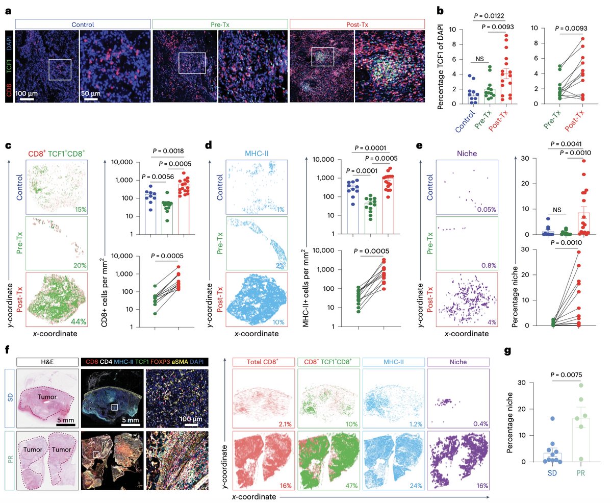 Out today in <a href="/NatureCancer/">Nature Cancer</a>: after neoadjuv cabo, ⏫T cell activation &amp; immune niche formation in pts with advanced RCC. 

+ truly delighted to have been a part of this exciting study from <a href="/HaydnKissick/">Haydn Kissick</a>, <a href="/bilenma/">Mehmet Asim Bilen,MD</a>, and <a href="/virajmaster/">Viraj Master</a> and many other friends back at <a href="/WinshipAtEmory/">Winship Cancer Institute of Emory University</a>!