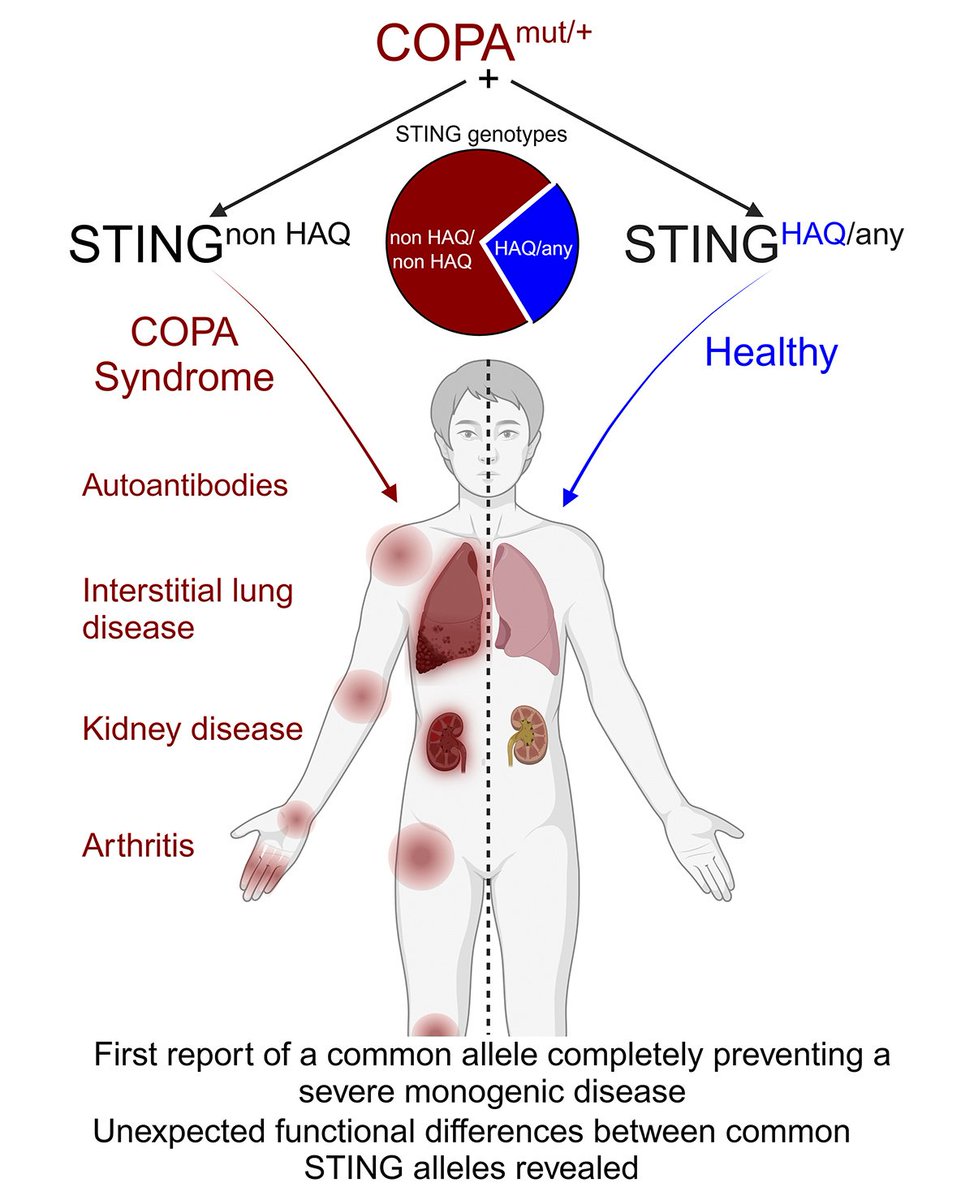 Journal of Experimental Medicine (@jexpmed) on Twitter photo HAQ STING protects individuals from developing COPA syndrome, the 1st time a common allele is shown to prevent severe genetic disease. Simchoni et al. reveal functional differences among STING alleles that impact health. hubs.la/Q038C4-J0
<a href="/chILD_US/">chILD Foundation</a>, <a href="/ACRheum/">American College of Rheumatology</a>, <a href="/atscommunity/">American Thoracic Society (ATS)</a> HAQ STING protects individuals from developing COPA syndrome, the 1st time a common allele is shown to prevent severe genetic disease. Simchoni et al. reveal functional differences among STING alleles that impact health. hubs.la/Q038C4-J0
<a href="/chILD_US/">chILD Foundation</a>, <a href="/ACRheum/">American College of Rheumatology</a>, <a href="/atscommunity/">American Thoracic Society (ATS)</a>