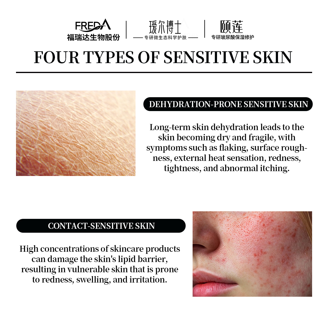 thefredabio's tweet image. Did you know there are four main types of sensitive skin? Whether it’s dryness, redness, irritation, or reactivity, your skin deserves the best care! 💆‍♀️✨

At Dr. Alva and Rellet, we’ve crafted solutions tailored to each unique concern.
#DrAlva #Rellet #SensitiveSkinSolutions
