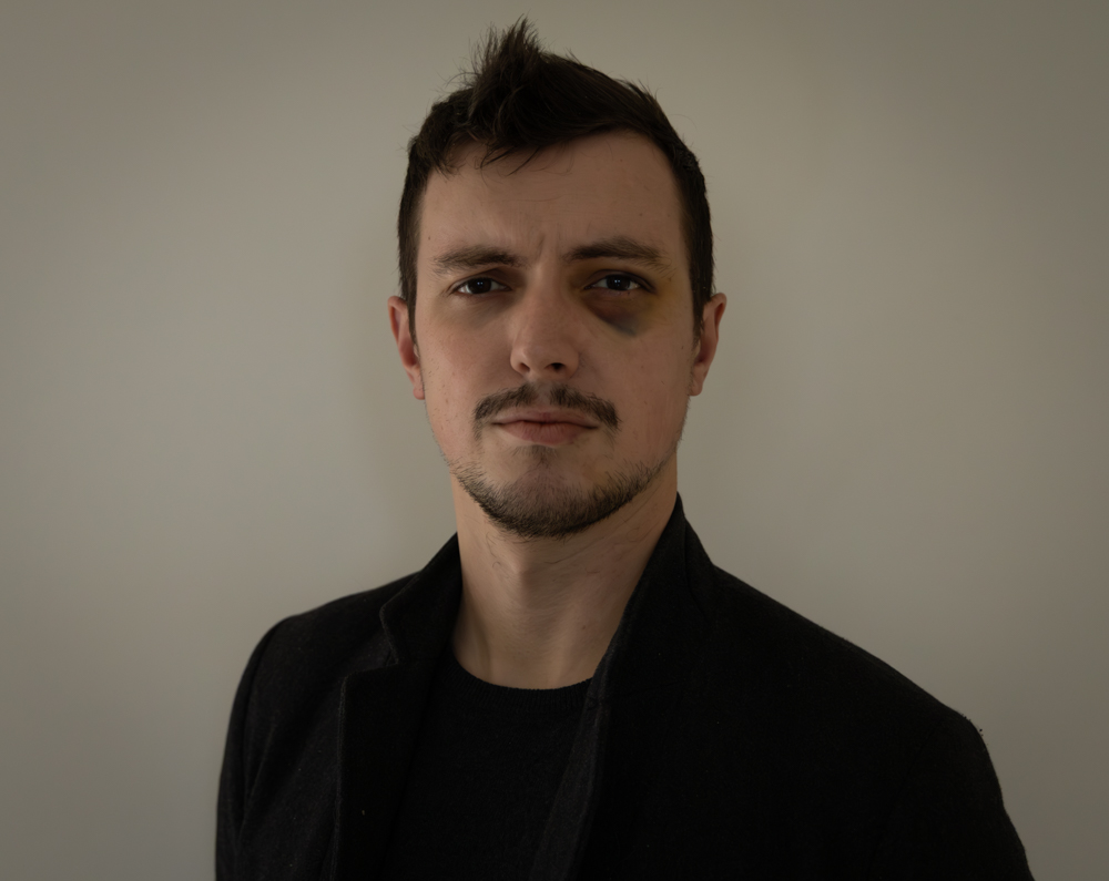 Je tiens à remercier toutes les personnes, citoyens élus et organisation politiques, qui m’ont exprimé leur soutien suite à l’agression de samedi. 6 pers. animés par des idées d’extrême droite nous ont attaqués, un ami &amp; moi, après avoir fait slogans racistes et saluts nazis 1/