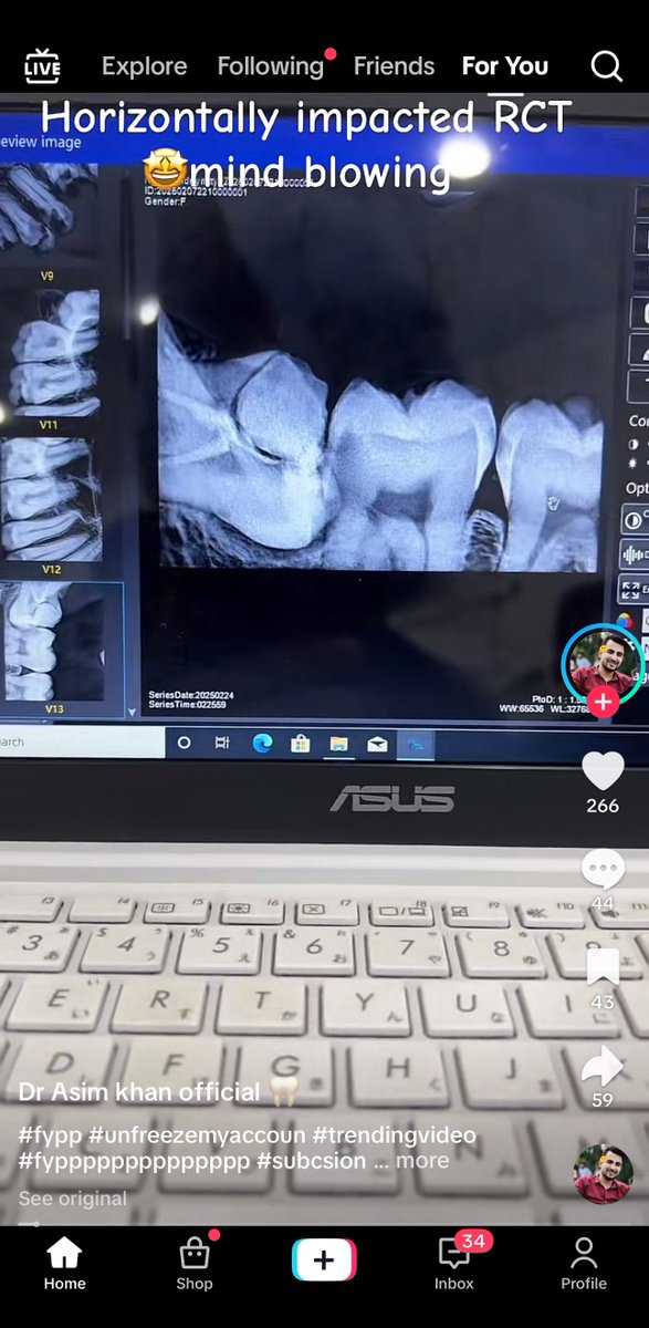 🤣🤣🤣🤣🤣 مب طبيعي والله