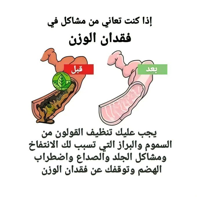 أقوى وصفتين لتنظيف المعدة والقولون من الفضلات والسموم 🚨🚨
بسردها لكم أسفل التغريدة 

لو مشغول فضلها بتفيدك وارجع لها بعدين 🤍