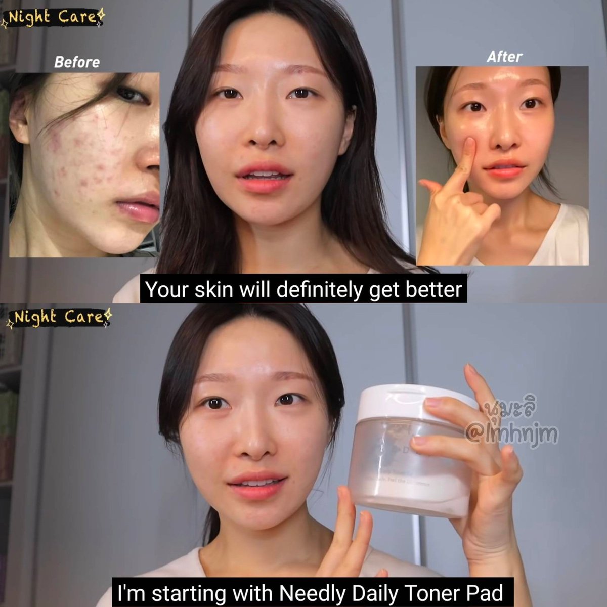 ꔛ โปรems19฿ / 3ชิ้นส่งฟรี

— NEEDLY Daily Toner Pad
ผลัดเซลล์ผิวอย่างอ่อนโยน
ลดอักเสบ ลดอุดตัน ลดรอยสิว
ปลอบประโลมผิว รูขุมขนกระชับ 

❤️ พร้อมส่ง 459.-