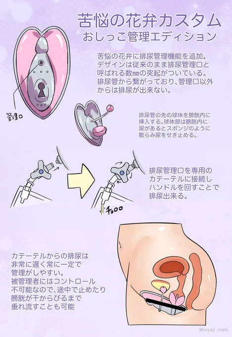 オリジナル貞操帯に排尿管理機能を追加 