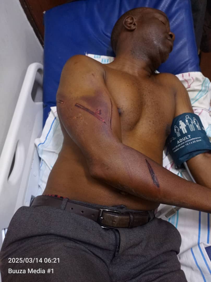 DavidLRubongoya's tweet photo. The state of some of the @NUP_Ug leaders who we deployed as supervisors for yesterday's election. Hon. Dr. Hilderman together with Hon. Kayemba Solo were first grabbed by the military, and later Mayor Walukaga. They were violently assaulted and spent the whole day in a drone. They were dumped in Kiruddu past 1:00am. As for Kira Municipality Mayor Julius Mutebi, he was grabbed violently, beaten very badly with wires and batons and dumped in Mutundwe at 3:00am. 
Our brothers Big Eye, Wiser and many others are still in detention at Kawempe police while others are still missing. We also have many who are in different hospitals nursing wounds. Their only crime was trying to guard the election and prevent the rigging that was so evident!!! This in addition to the grave attack on the journalists. 

How can the regime be so callous? How can they hate the citizens so much? How can they fear the people so much? ULTIMATELY, the people rise and reclaim this country. 
#FreeUganda 
#StopAbuseOfPowerUg